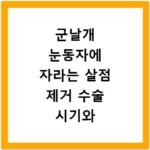 군날개 눈동자에 자라는 살점 제거 수술 시기와 통증 정도