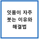 잇몸이 자주 붓는 이유와 해결법